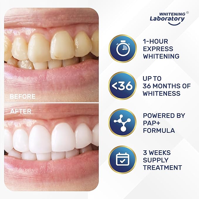 Professional Teeth Whitening Strips - 21 Sessions - Safe for Enamel - 42 Peroxide-Free Strips with Mouth Opener - Removes Deep Stains