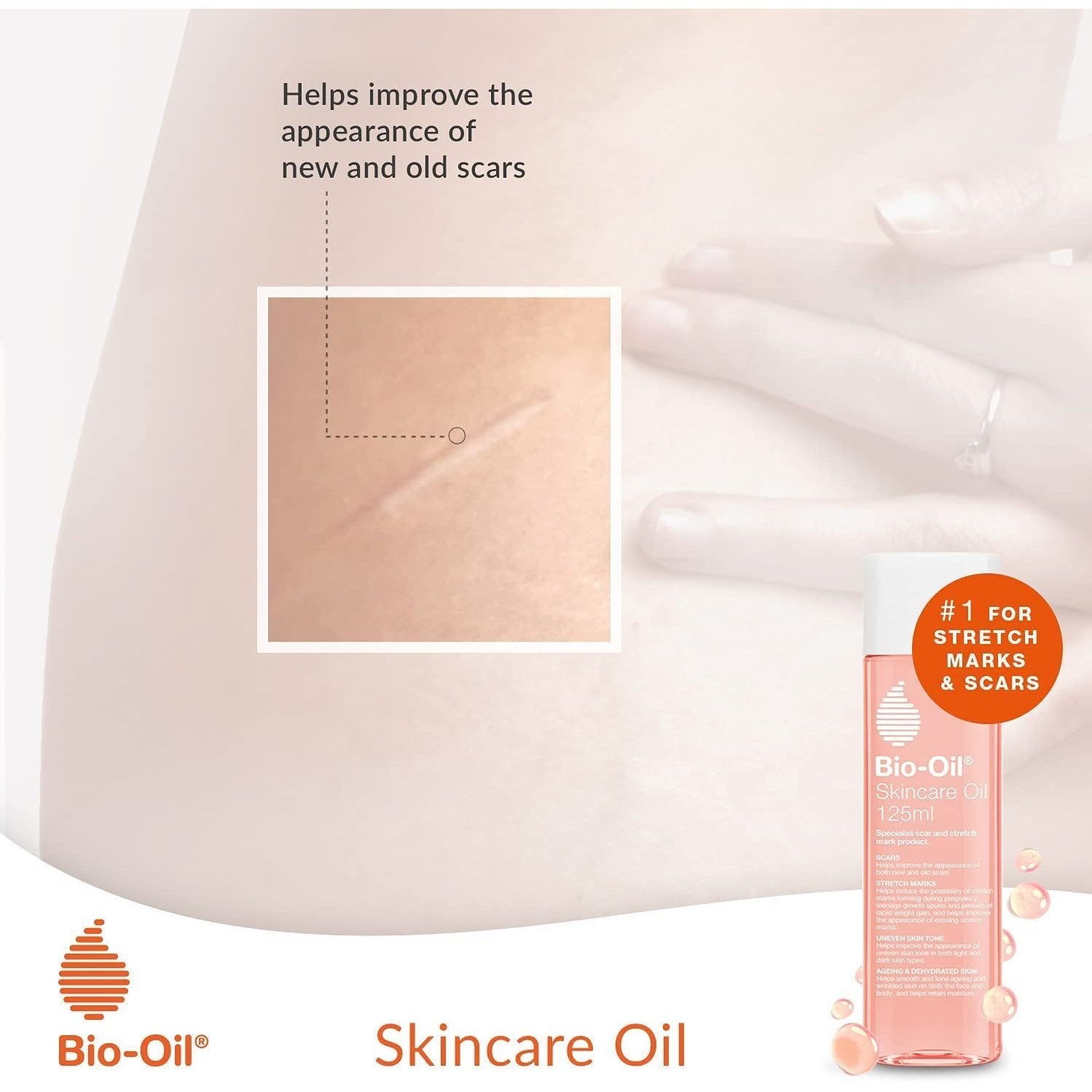 Skincare Oil - Improve the Appearance of Scars, Stretch Marks and Skin Tone - 1 X 60 Ml Clear Store