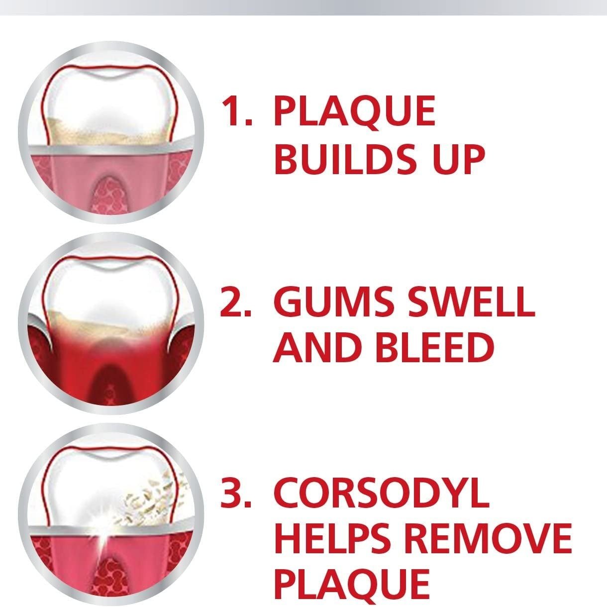 Mouthwash 0.2%, Gum Disease & Bleeding Gum Treatment Mouthwash, Alcohol Free, Mint Flavour, 300 Ml (Pack of 1) Clear Store