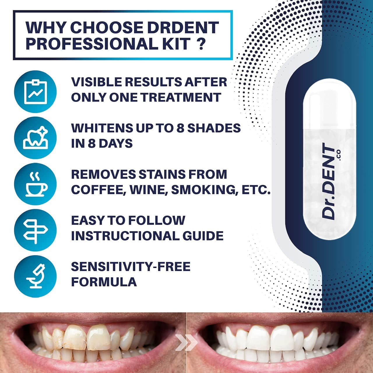 Professional LED Teeth Whitening Kit - Sensitivity Free Formula - 8 Teeth Whitening Gel Pods 33.6Ml - Helps to Remove Stains - Includes Mouth Tray & Shade Guide - Rapid & Effective Results