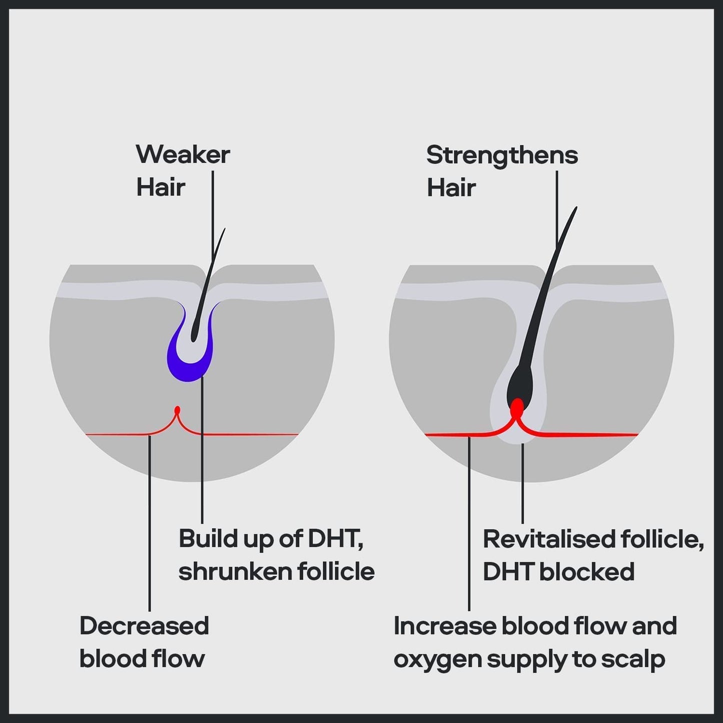 Hair Regrowth Minoxidil 5% 1 Month - for Men'S Hair Loss - Reactivates Shrunken Hair Follicles - Unique Precision Applicator System