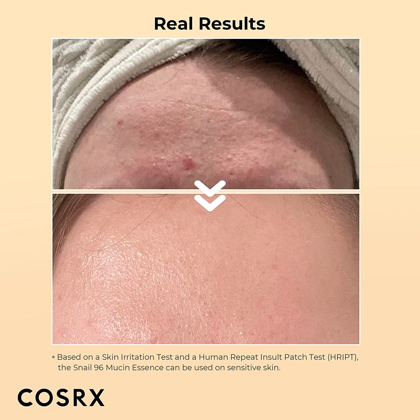 COSRX Advanced Snail 96 Mucin Power Essence 100Ml | Snail Secretion Filtrate 96% | Skin Repair Serum | CPNP Registered | Korean Skin Care, Cruelty Free, Paraben Free